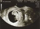 10-week-ultrasound-1050.jpg