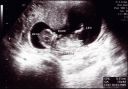 12-weeks-pregnant-ultrasound.jpg