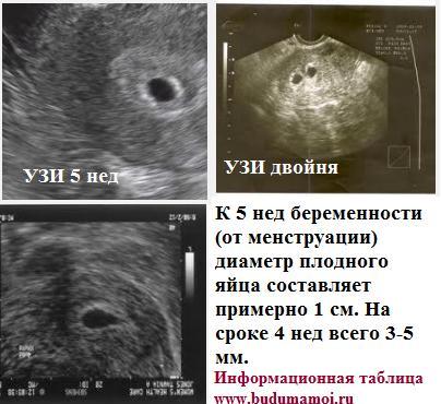 Фото Узи На 5 6 Неделе